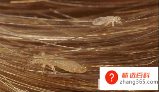 头上长虱子怎么去除(去除头上长虱子的情况可以采用多种方式)