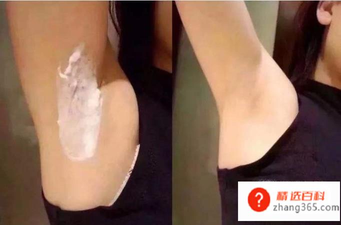 如何自己脱腋毛